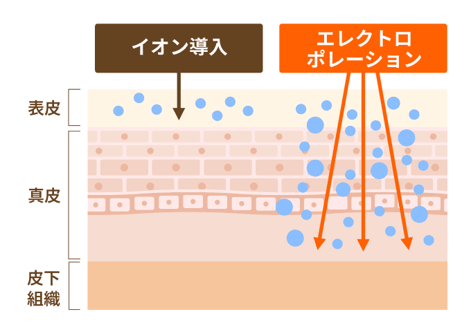 イオン導入 エレクトロポレーション違い