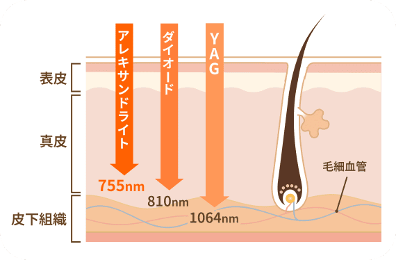 レーザーの種類と波長