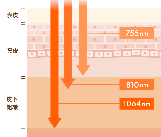 レーザーの種類と波長